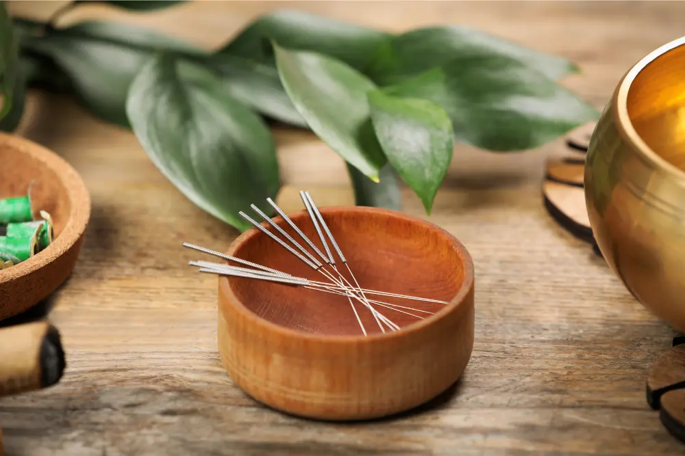 Beyond Western Medicine: Acupuncture's Role in Optimising Fertility Potential